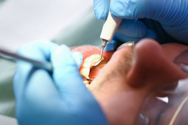 Best Emergency Treatment for Toothache in Plummer, ID